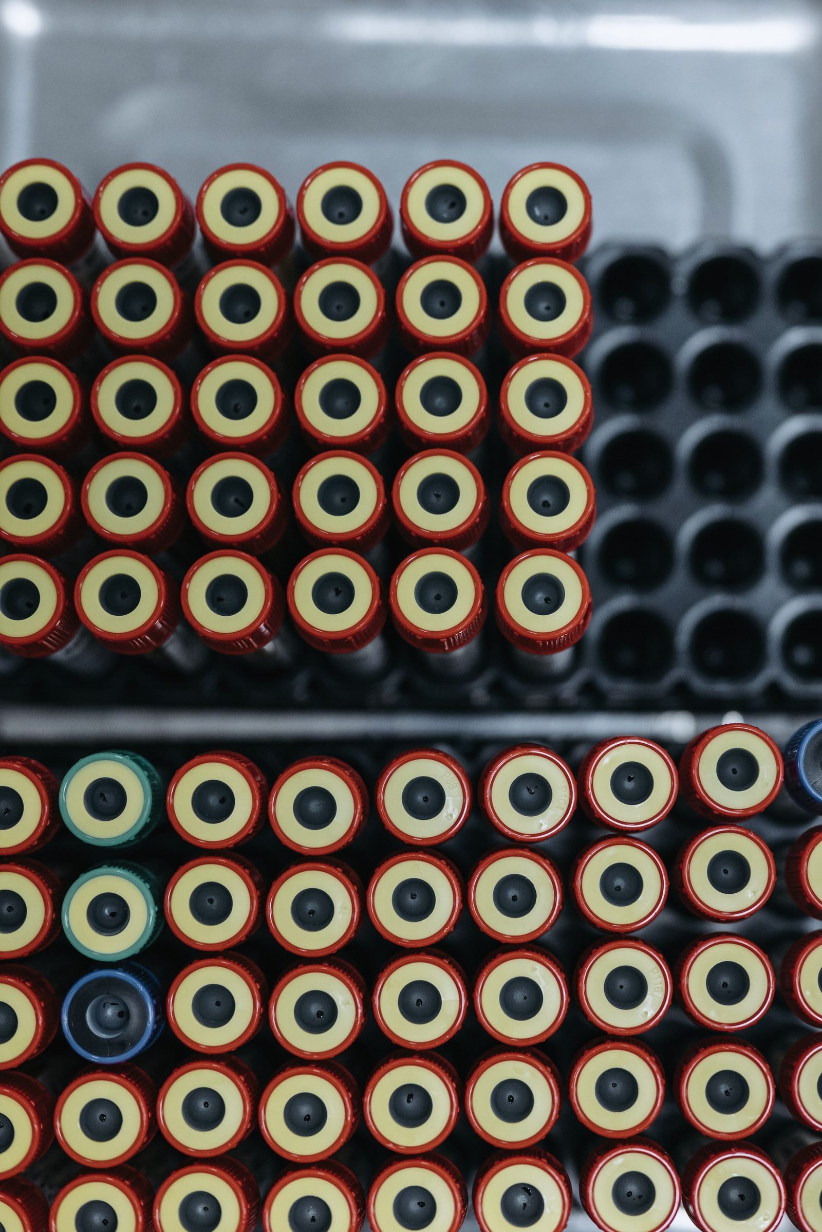 Capped blood collection tubes arranged in laboratory racks